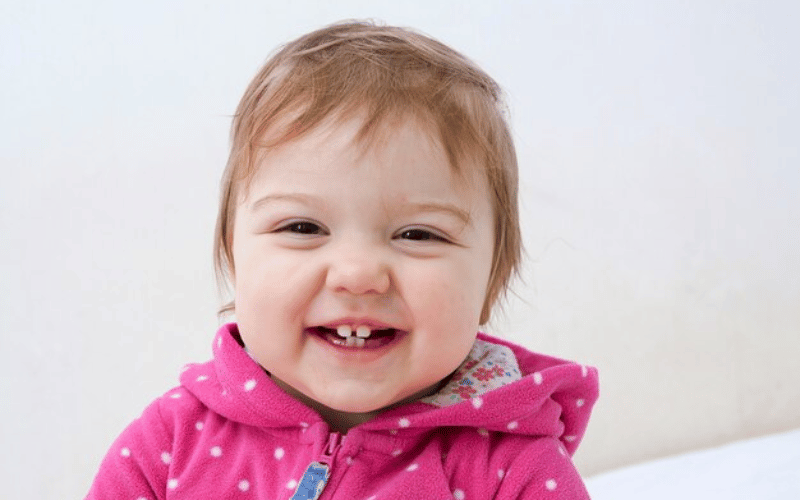 can baby teeth issues impact permanent teeth coming in