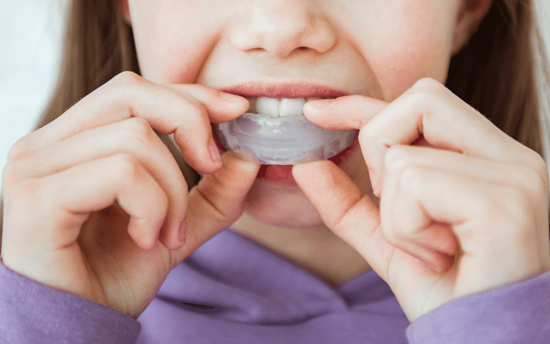 mouthguards for mini athletes