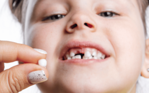 Tooth Extraction For Kids