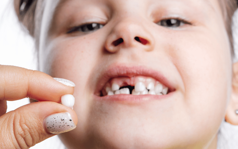 Tooth Extraction For Kids
